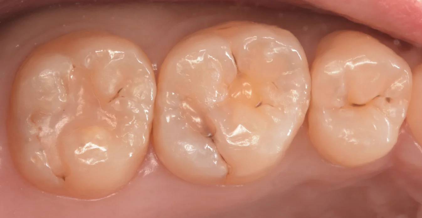 大田区からお越しの方｜坂寄歯科医院（取手市藤代）