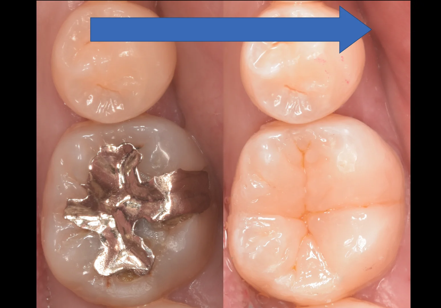 印西からお越しの方|坂寄歯科医院(取手市藤代) - 画像6