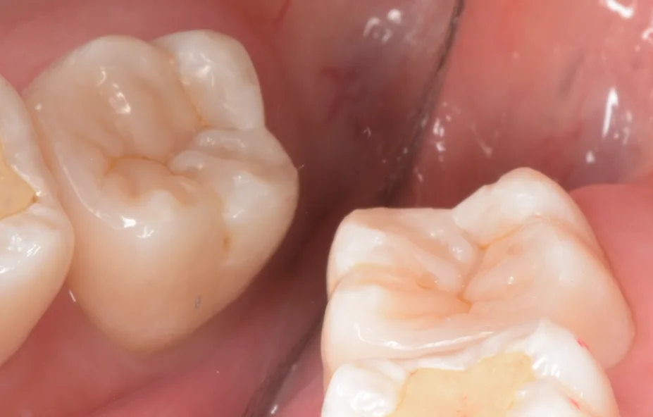 足立区からお越しの方。|坂寄歯科医院(取手市藤代) - 画像9