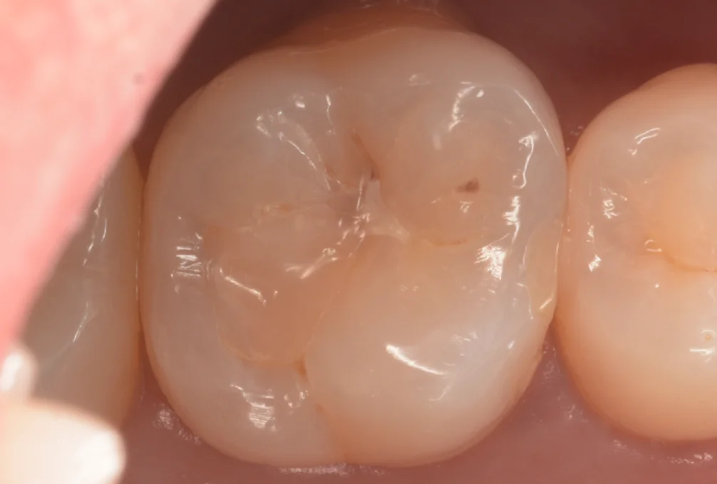 印西からお越しの方。|坂寄歯科医院(取手市藤代)