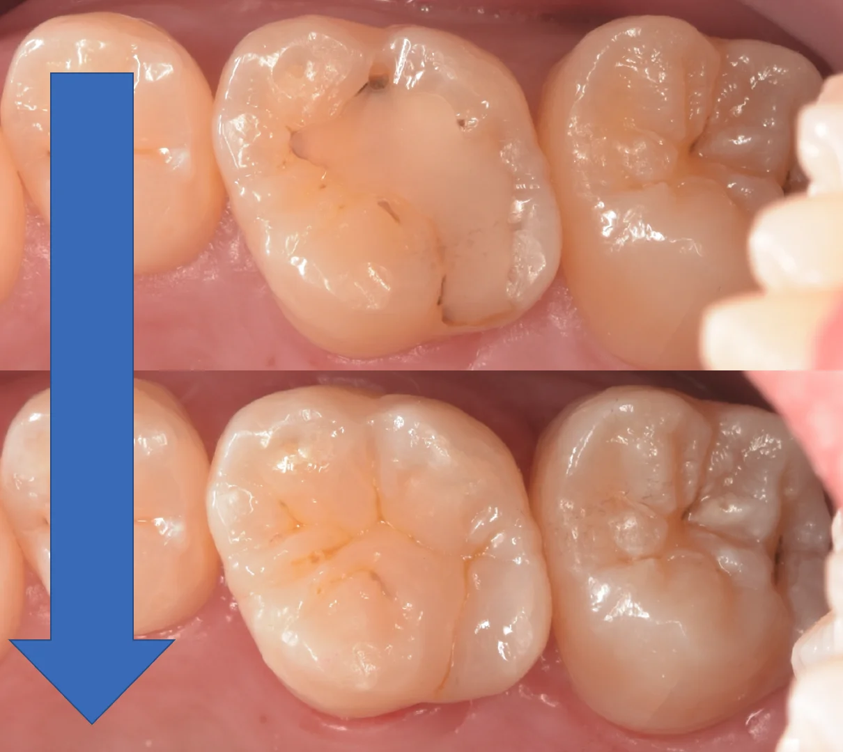 竜ヶ崎市からお越しの方。|坂寄歯科医院(取手市藤代) - 画像5