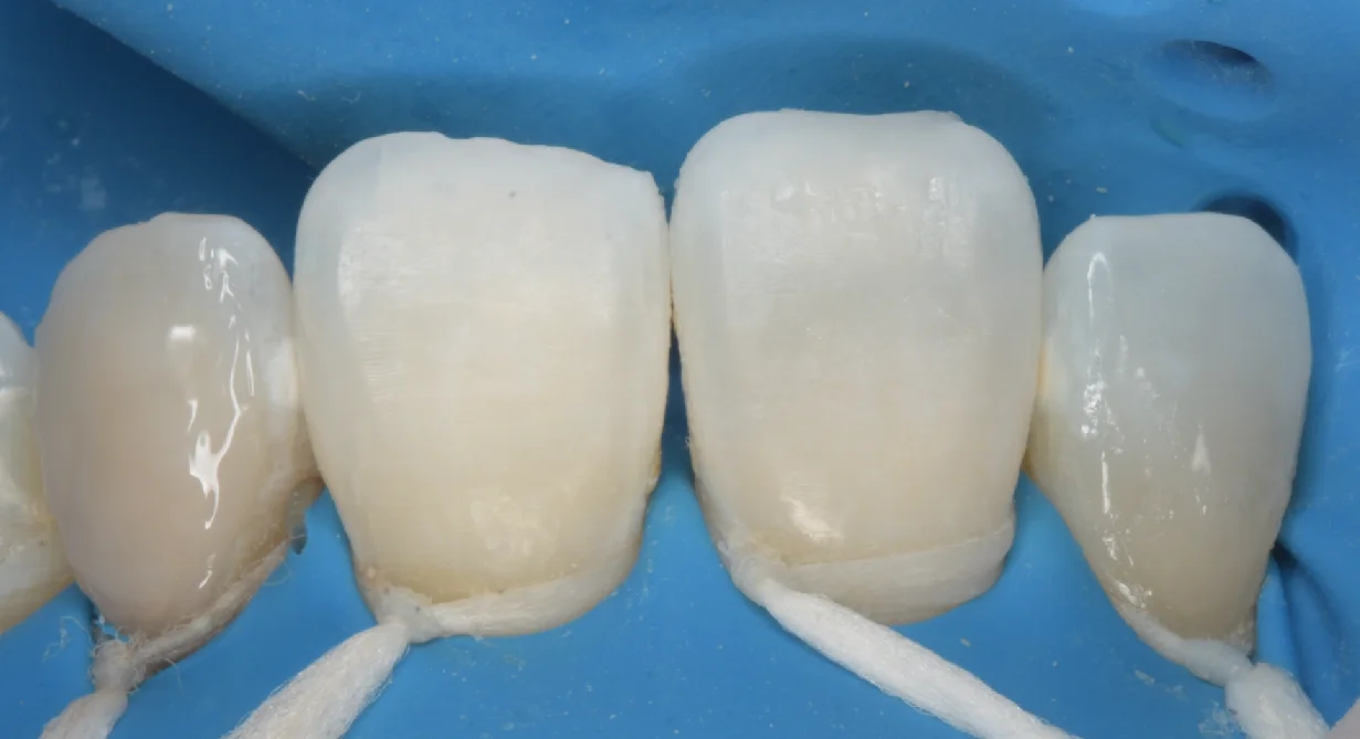 目黒からお越しの方|坂寄歯科医院(取手市藤代) - 画像3