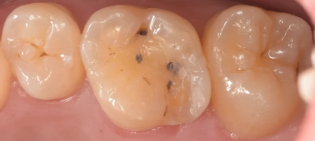 竜ヶ崎市からお越しの方。|坂寄歯科医院(取手市藤代) - 画像2