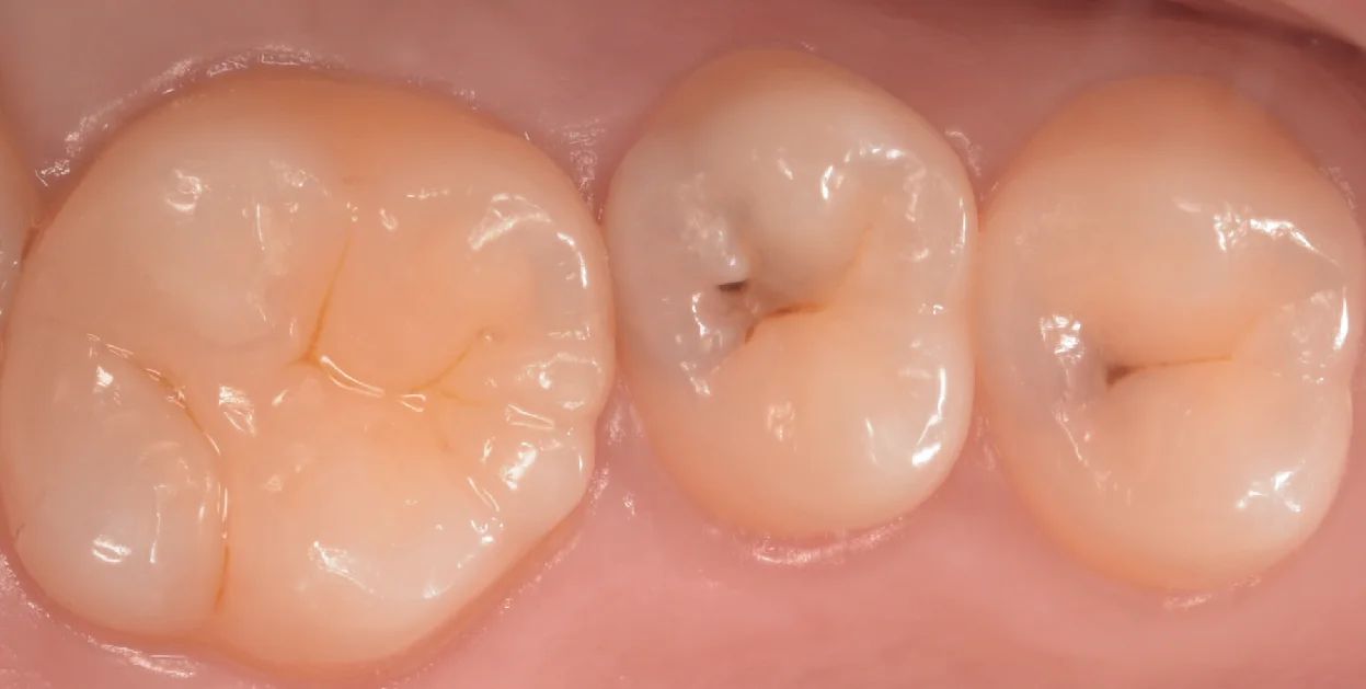 夢の国近辺から通院中の方。｜坂寄歯科医院（取手市藤代）