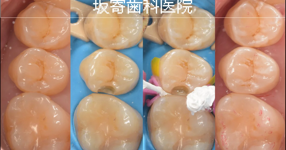 ブログ・お役立ち情報｜坂寄歯科医院（取手市藤代）