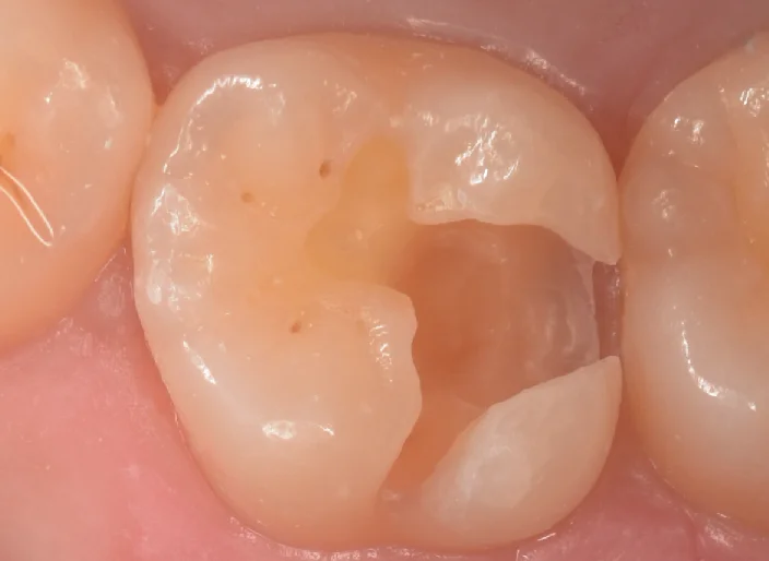 浦安からお越しの方。|坂寄歯科医院(取手市藤代) - 画像6