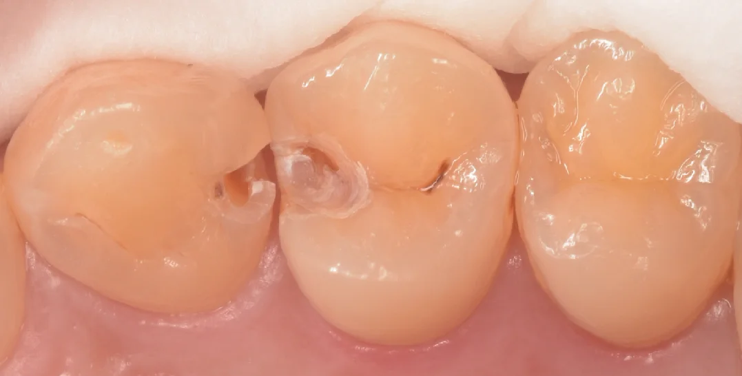 千葉からお越しの歯科衛生士さん。|坂寄歯科医院(取手市藤代) - 画像2