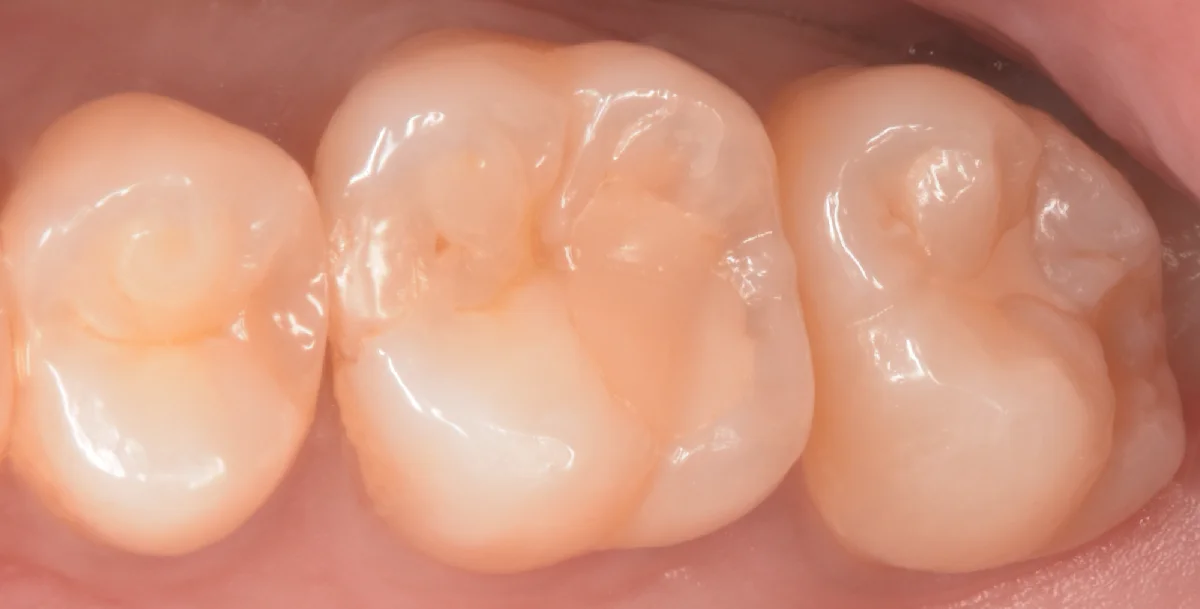 印西市からお越しの方。｜坂寄歯科医院（取手市藤代）