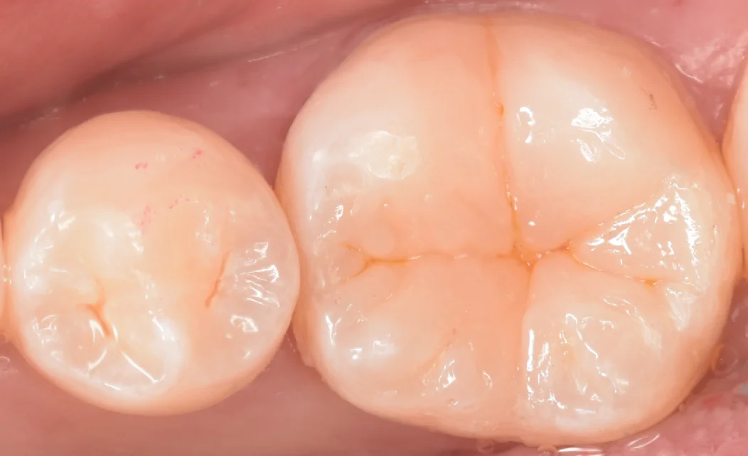 印西からお越しの方|坂寄歯科医院(取手市藤代) - 画像5