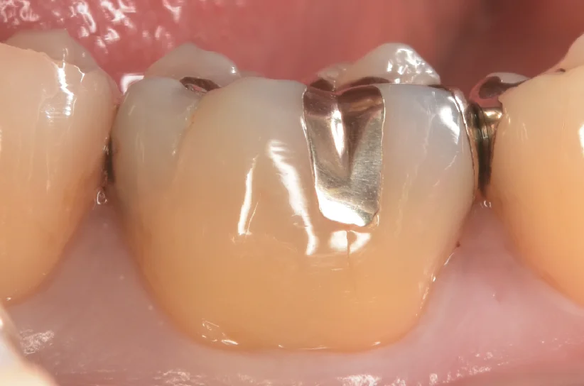 栃木県からお越しの方。｜坂寄歯科医院（取手市藤代）