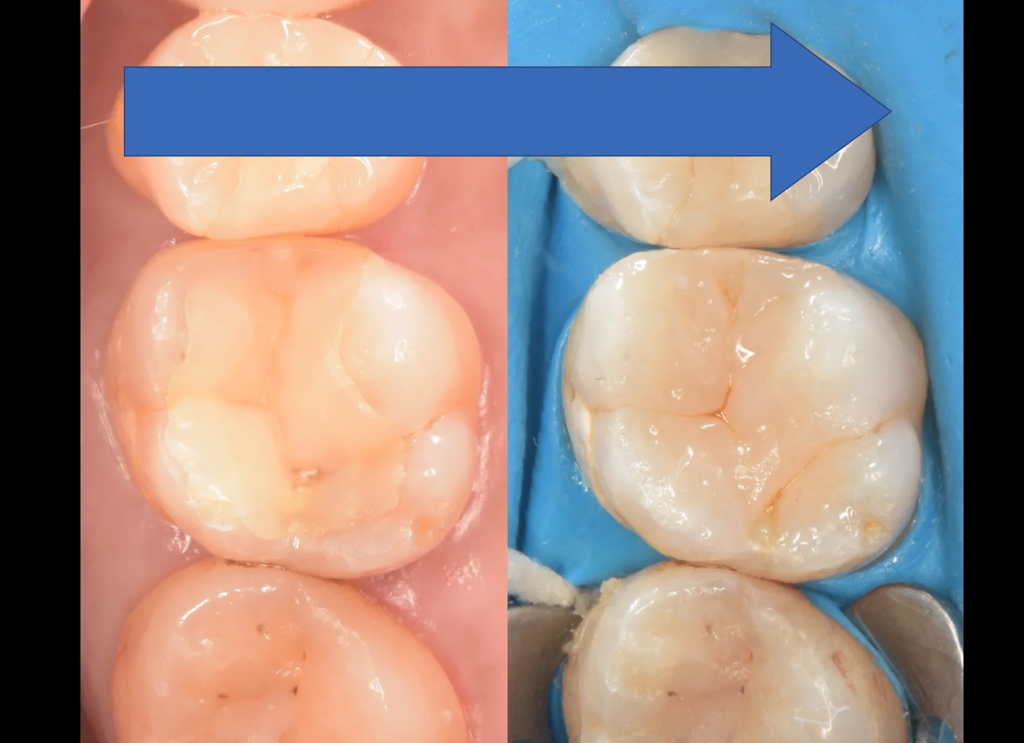 新宿からお越しの方|坂寄歯科医院(取手市藤代) - 画像5