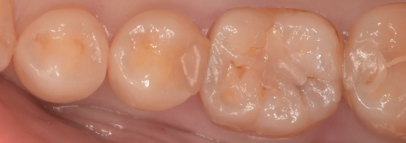 三鷹より来院された方|坂寄歯科医院(取手市藤代)