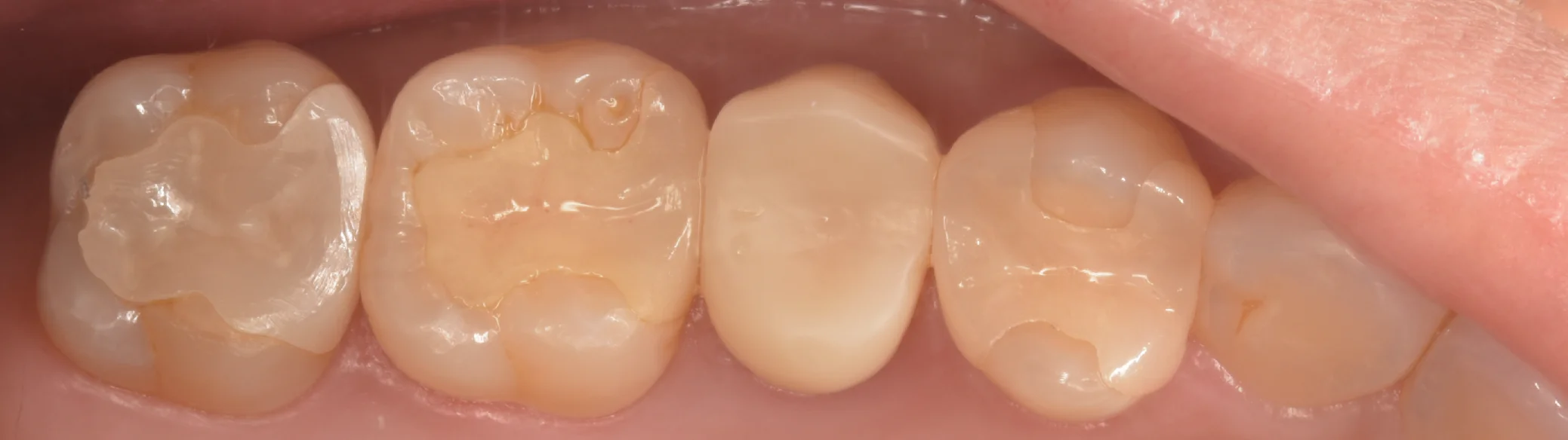 足立区からお越しの方。|坂寄歯科医院(取手市藤代)