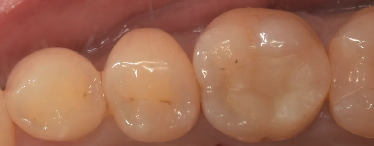 埼玉県からお越しの方｜坂寄歯科医院（取手市藤代）