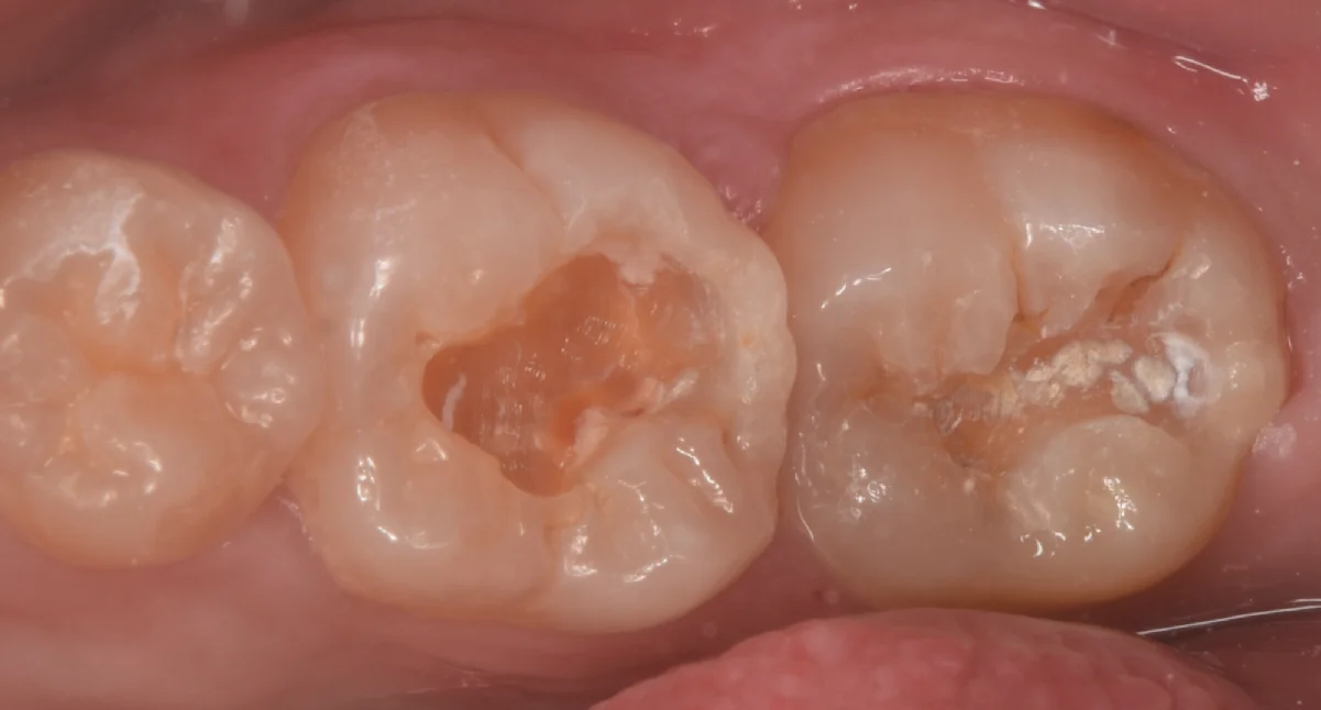 竜ヶ崎市からお越しの方。｜坂寄歯科医院（取手市藤代） - 画像2