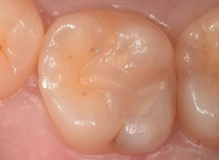 浦安からお越しの方。|坂寄歯科医院(取手市藤代) - 画像4