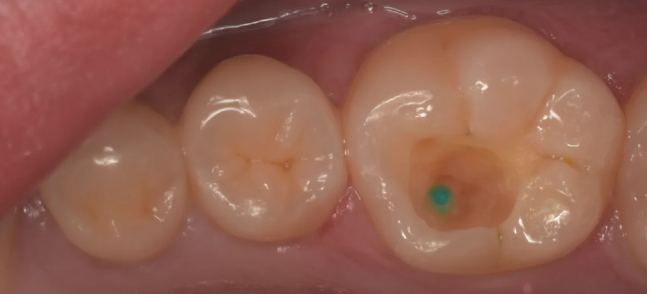歯学部生をダイレクトで。|坂寄歯科医院(取手市藤代) - 画像3