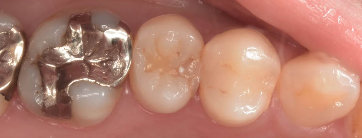 歯科医師の方を治療。｜坂寄歯科医院（取手市藤代）