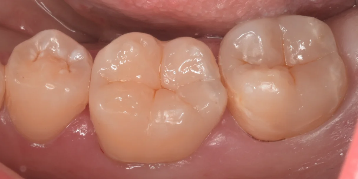 市川市からお越しの方。｜坂寄歯科医院（取手市藤代） - 画像3