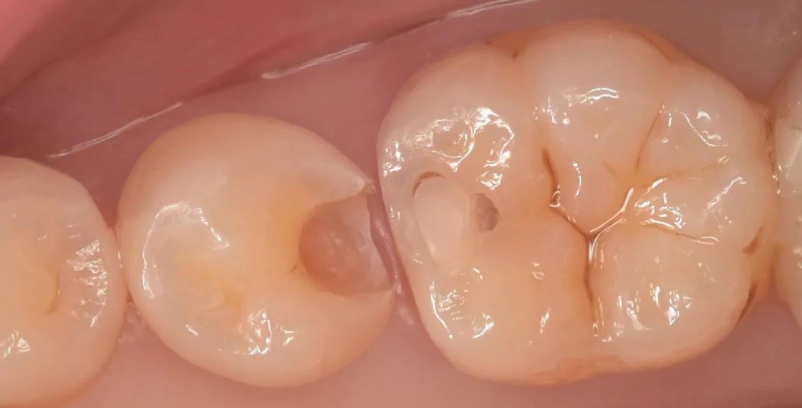 東京都内よりお越しの方をダイレクトで。|坂寄歯科医院(取手市藤代) - 画像3