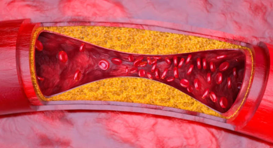 神経の治療⑤|坂寄歯科医院(取手市藤代) - 画像2