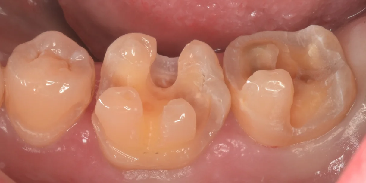 市川市からお越しの方。｜坂寄歯科医院（取手市藤代） - 画像2