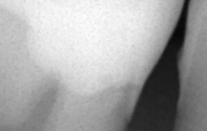 難易度の高い白い詰め物。|坂寄歯科医院(取手市藤代) - 画像7