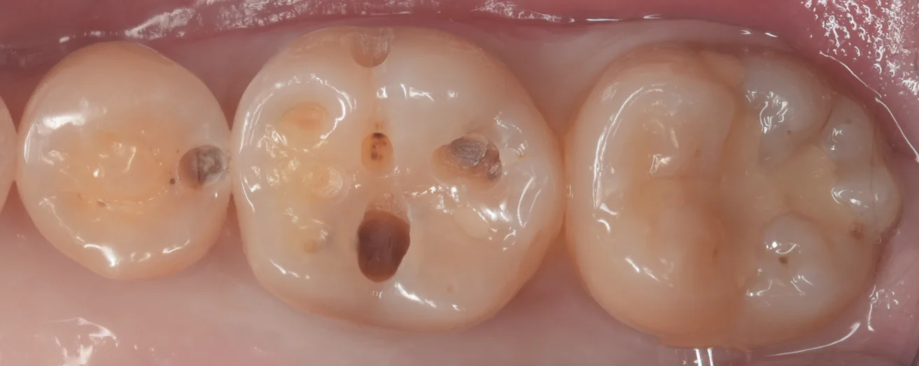 遠方からいらっしゃった歯科医師の方。|坂寄歯科医院(取手市藤代) - 画像2