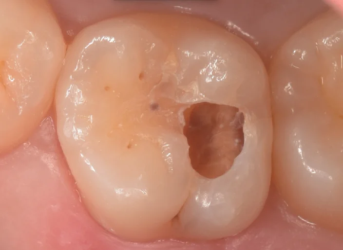 浦安からお越しの方。|坂寄歯科医院(取手市藤代) - 画像5