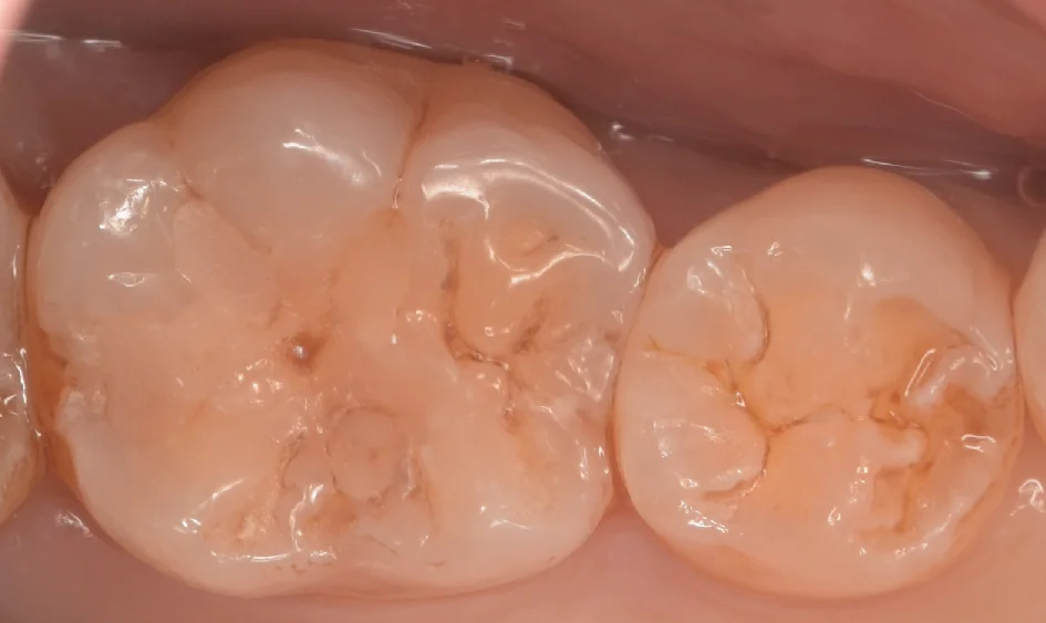 神奈川県からお越しの方|坂寄歯科医院(取手市藤代) - 画像3