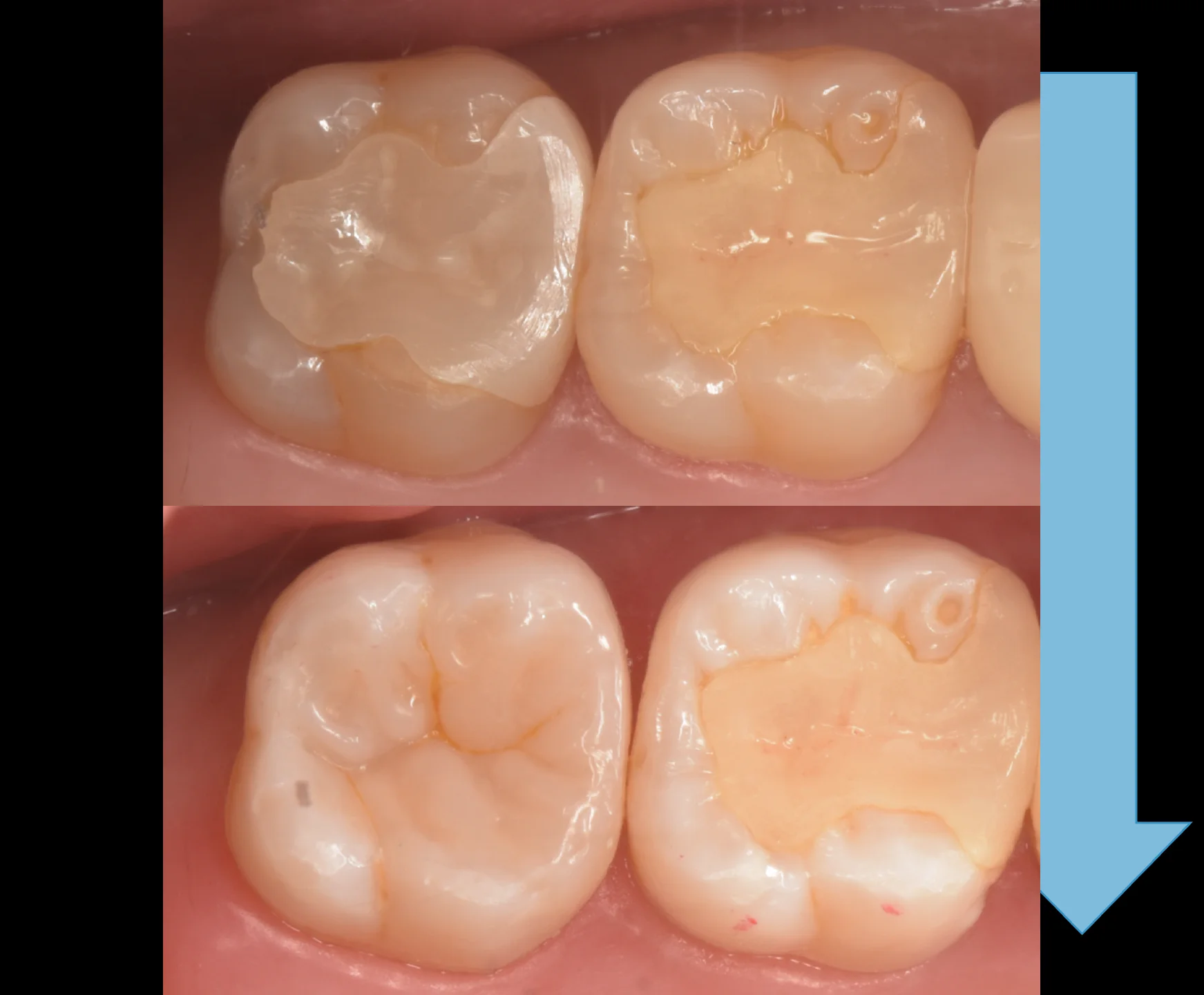 足立区からお越しの方。|坂寄歯科医院(取手市藤代) - 画像8