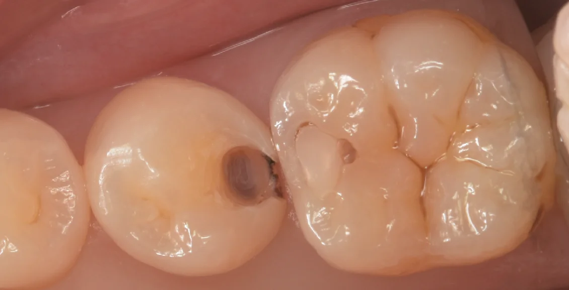 東京都内よりお越しの方をダイレクトで。|坂寄歯科医院(取手市藤代) - 画像2