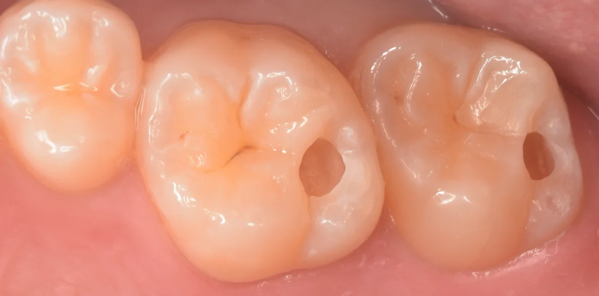 群馬からお越しの歯科医師の方。｜坂寄歯科医院（取手市藤代） - 画像3