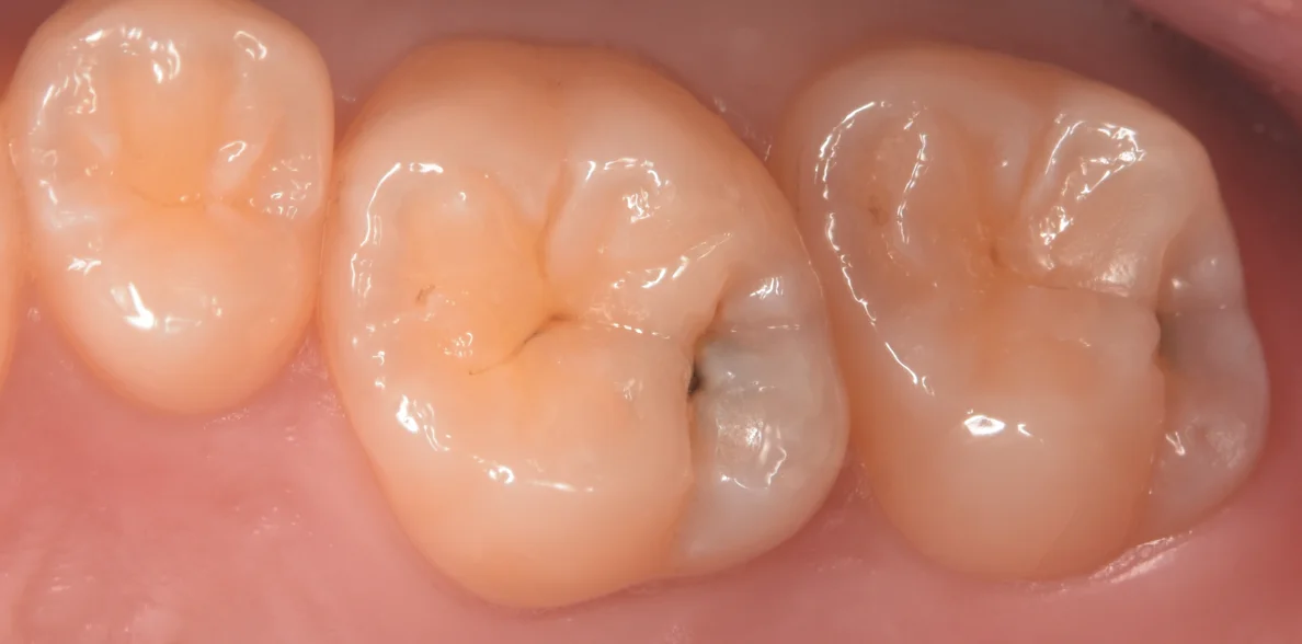 群馬からお越しの歯科医師の方。｜坂寄歯科医院（取手市藤代）