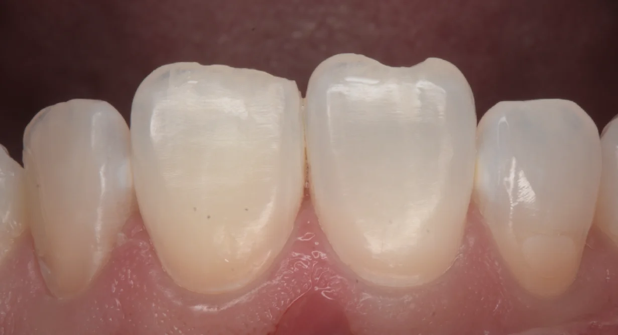 目黒からお越しの方|坂寄歯科医院(取手市藤代)