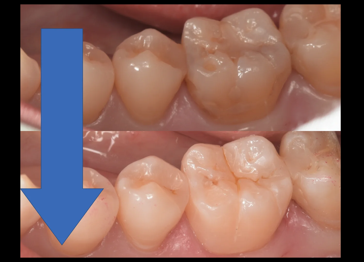 三鷹より来院された方|坂寄歯科医院(取手市藤代) - 画像10