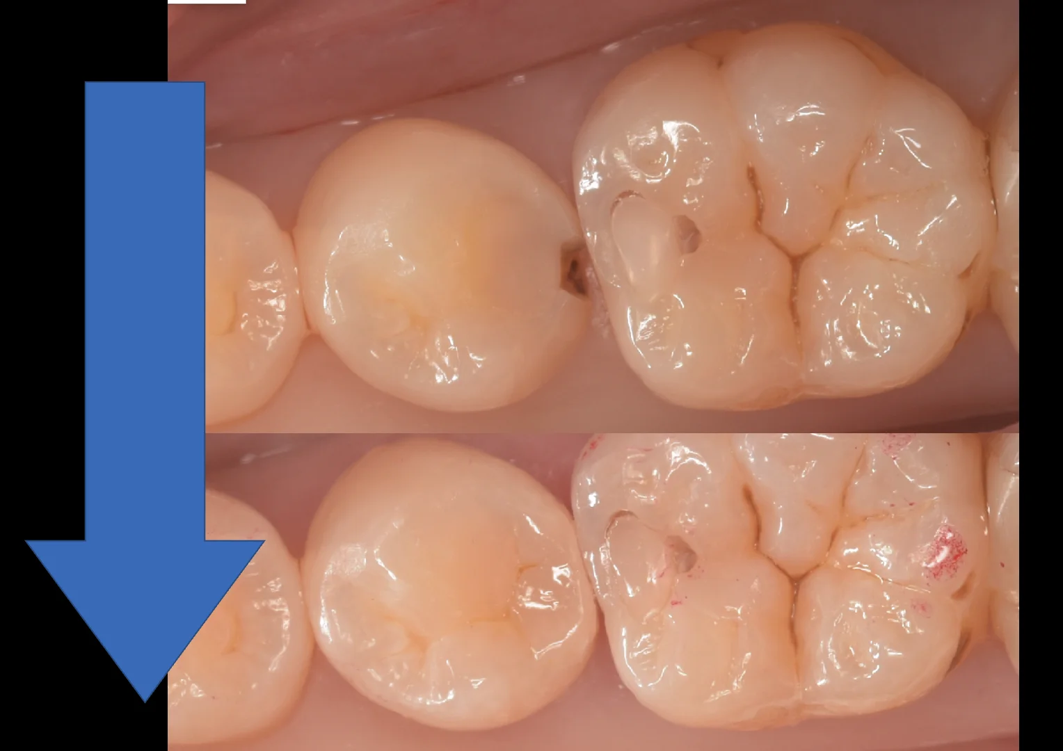 東京都内よりお越しの方をダイレクトで。|坂寄歯科医院(取手市藤代) - 画像5