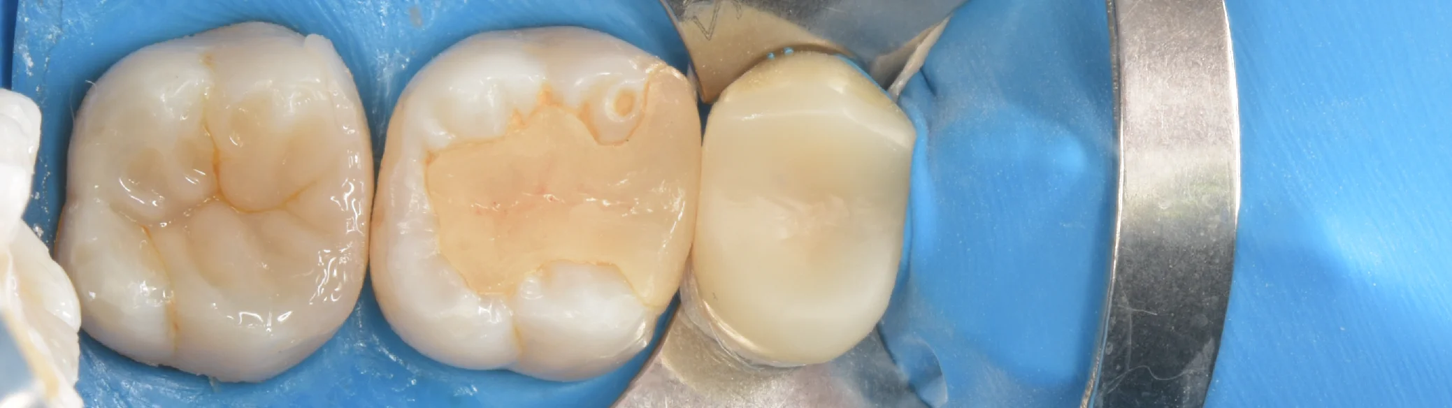 足立区からお越しの方。|坂寄歯科医院(取手市藤代) - 画像6