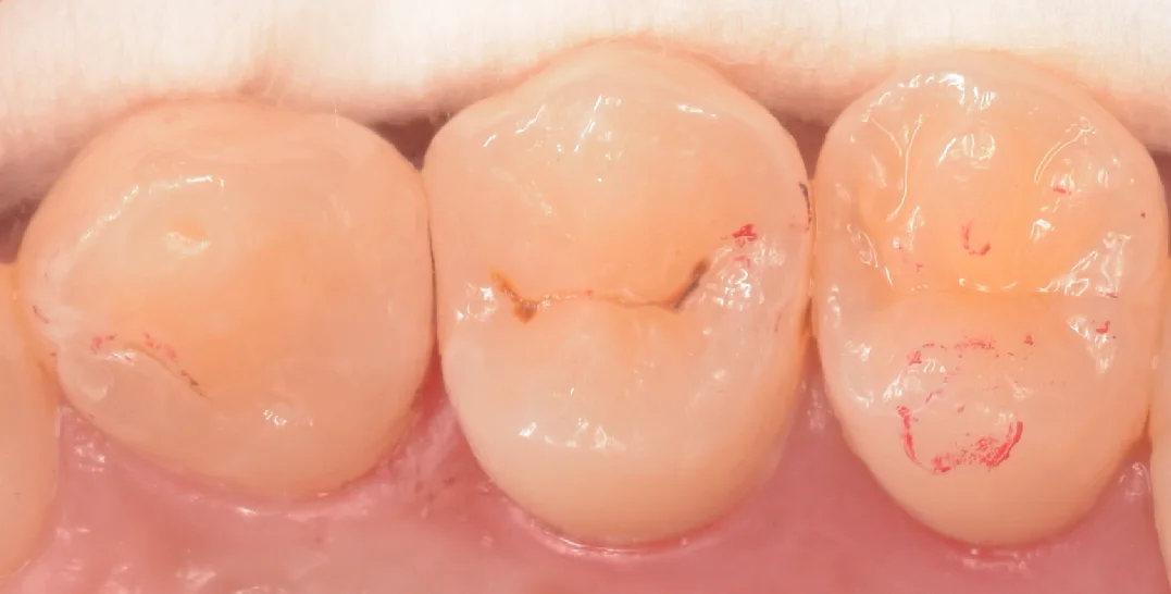 千葉からお越しの歯科衛生士さん。|坂寄歯科医院(取手市藤代) - 画像4