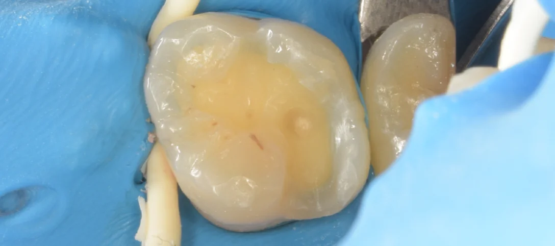 竜ヶ崎市からお越しの方。|坂寄歯科医院(取手市藤代) - 画像3