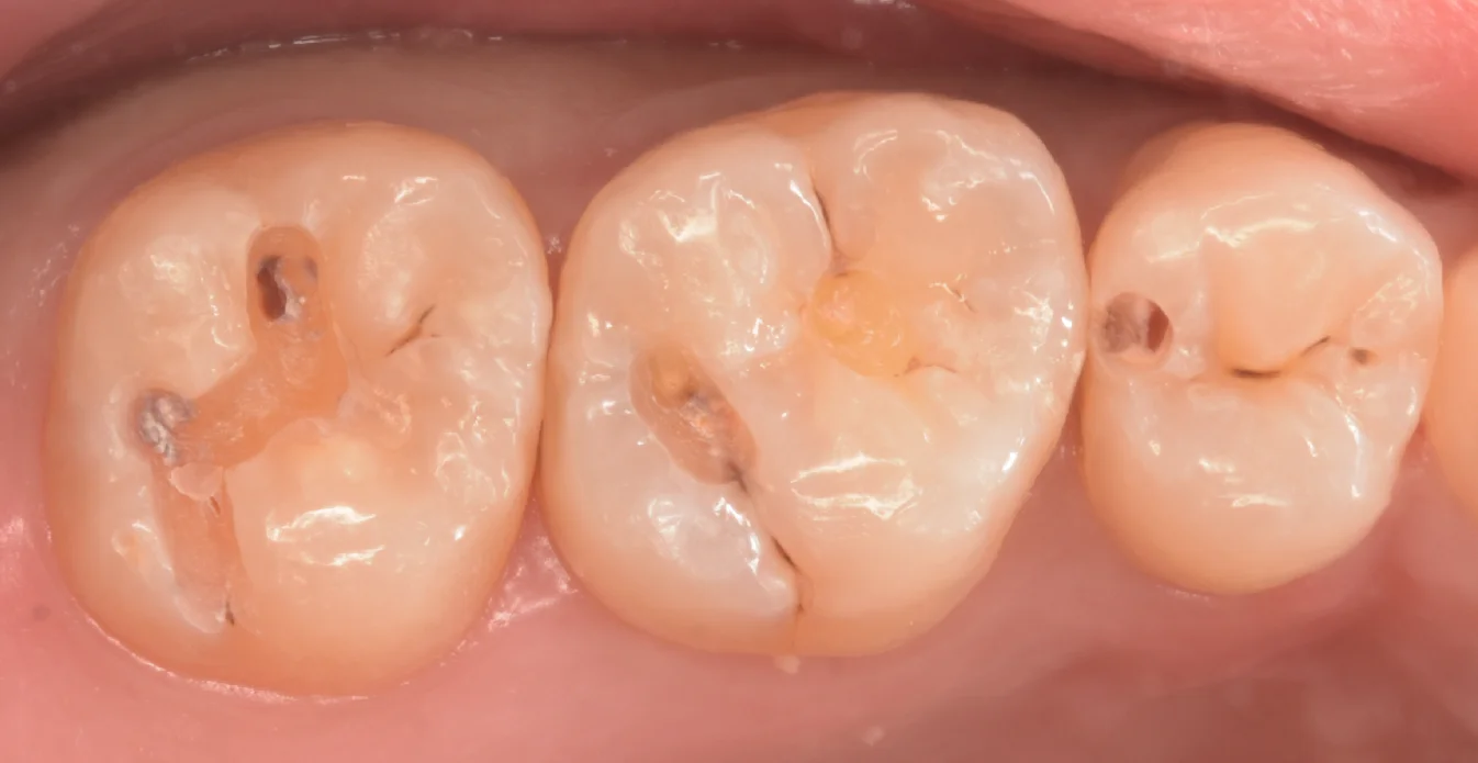 大田区からお越しの方｜坂寄歯科医院（取手市藤代） - 画像2