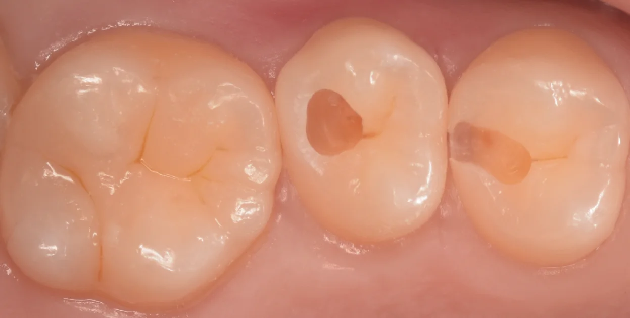 夢の国近辺から通院中の方。｜坂寄歯科医院（取手市藤代） - 画像3