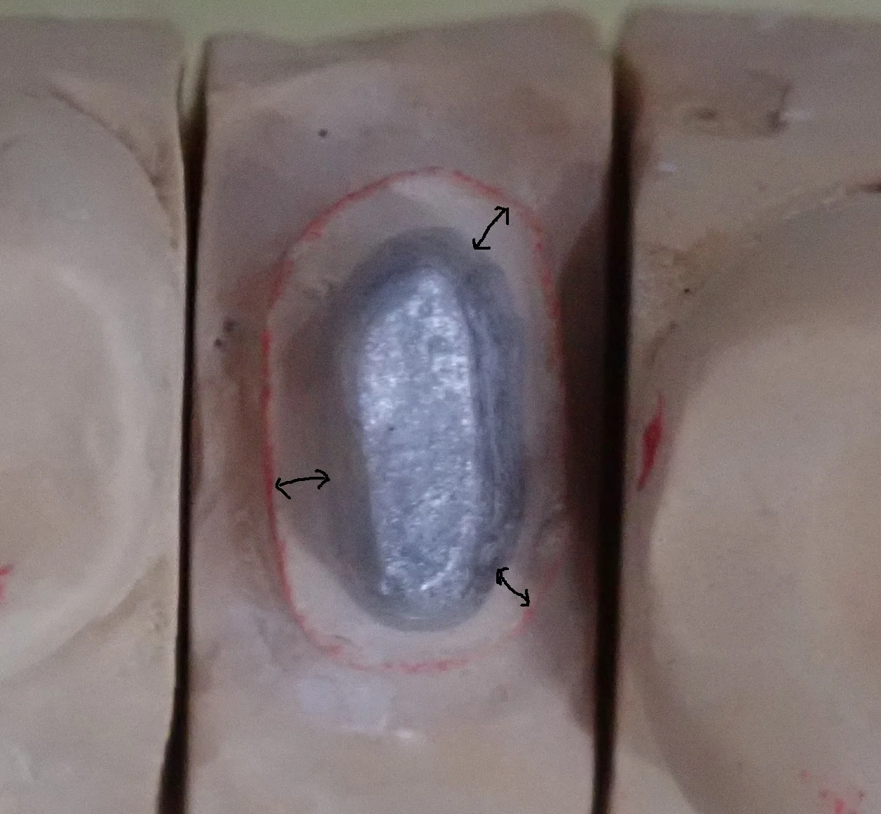 保険の白い被せ物|坂寄歯科医院(取手市藤代)