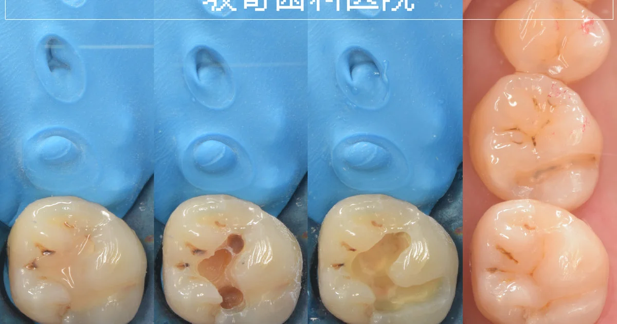 ブログ・お役立ち情報｜坂寄歯科医院（取手市藤代）