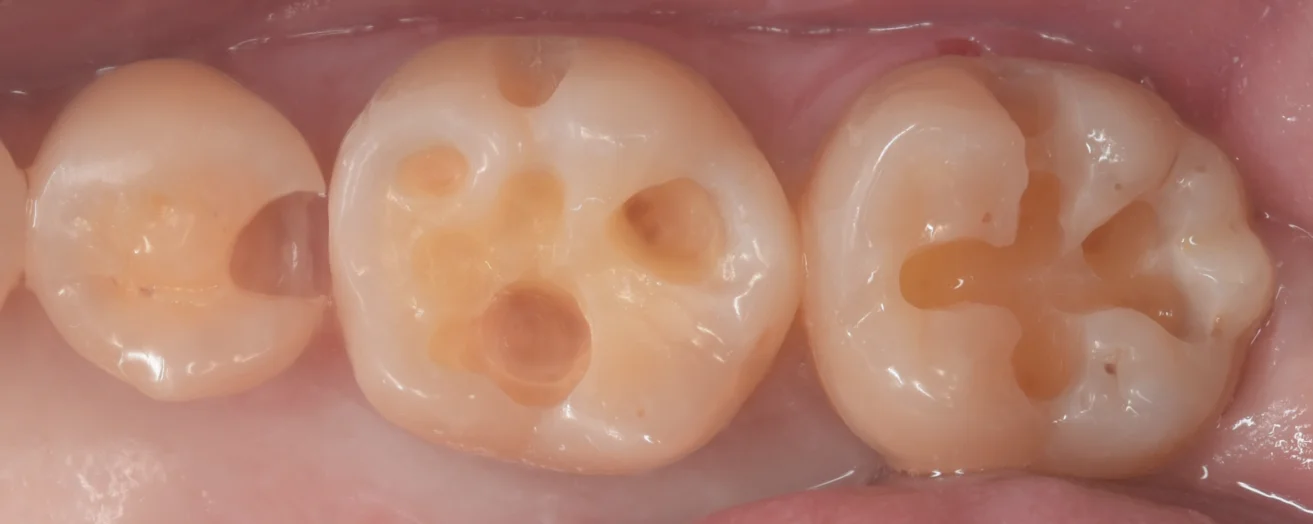 遠方からいらっしゃった歯科医師の方。|坂寄歯科医院(取手市藤代) - 画像3