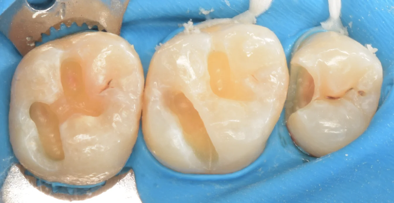 大田区からお越しの方｜坂寄歯科医院（取手市藤代） - 画像3