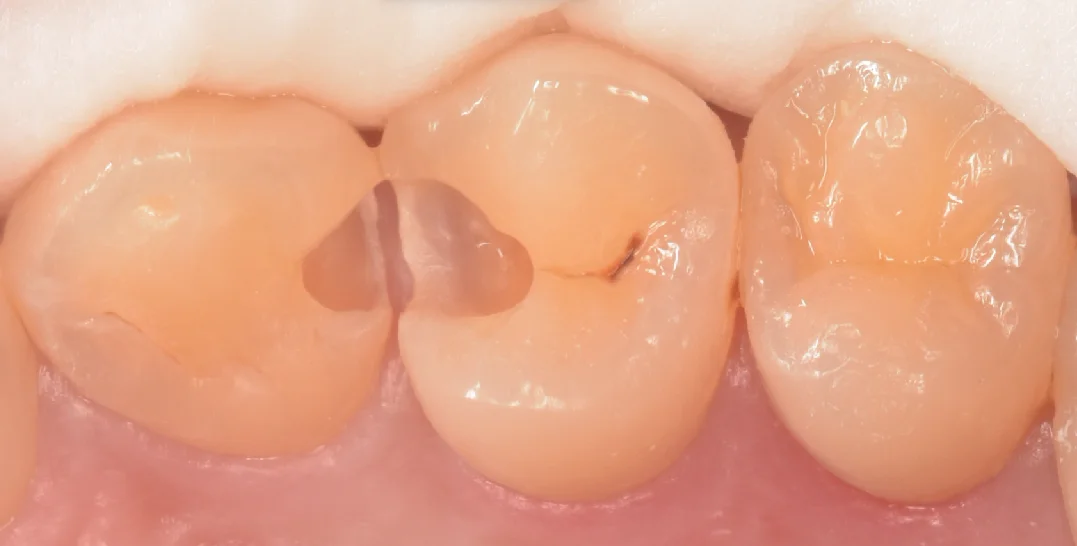 千葉からお越しの歯科衛生士さん。|坂寄歯科医院(取手市藤代) - 画像3