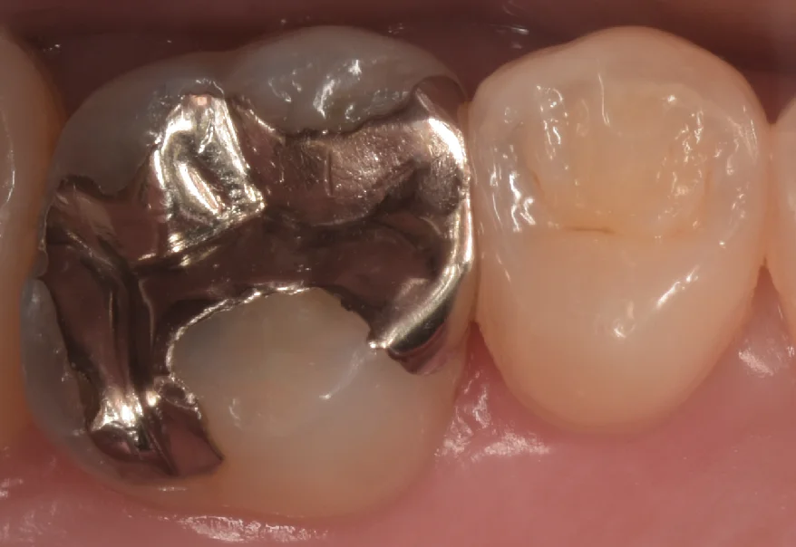 千葉県からお越しの方｜坂寄歯科医院（取手市藤代）