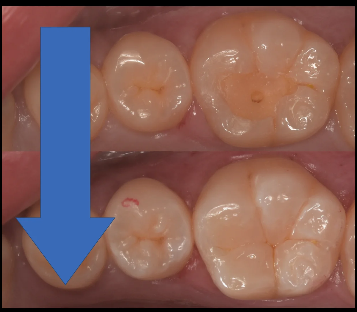 歯学部生をダイレクトで。|坂寄歯科医院(取手市藤代) - 画像7