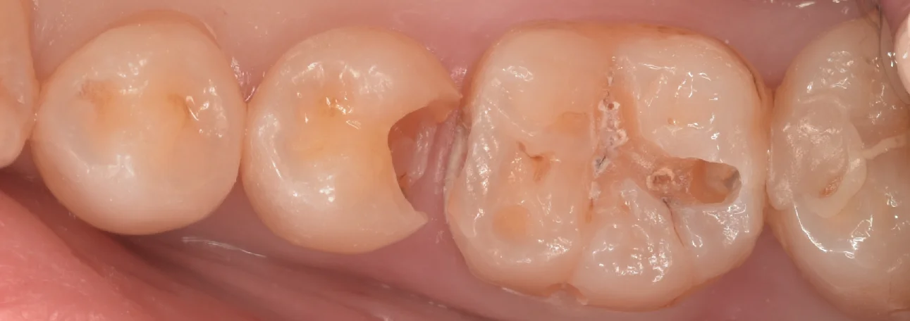 三鷹より来院された方|坂寄歯科医院(取手市藤代) - 画像3